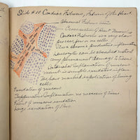1901 Pathology/Bacteriology Marbled Cover Notebook with Gorgeous Colored Pencil Illustrations Throughout, NYC