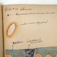 1901 Pathology/Bacteriology Marbled Cover Notebook with Gorgeous Colored Pencil Illustrations Throughout, NYC
