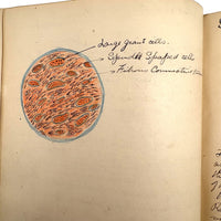 1901 Pathology/Bacteriology Marbled Cover Notebook with Gorgeous Colored Pencil Illustrations Throughout, NYC
