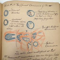 1901 Pathology/Bacteriology Marbled Cover Notebook with Gorgeous Colored Pencil Illustrations Throughout, NYC