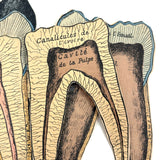 Scarce and Very Lovely Early 20th Century G. Eisenmenger Anatomical Paper Model of a Molar!