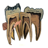 Scarce and Very Lovely Early 20th Century G. Eisenmenger Anatomical Paper Model of a Molar!