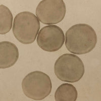 c. 1870 Microphotograph of Blood Cells Under Microscope, Dr. S. W. Fletcher, Pepperell MA (1 of 2)