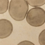 c. 1870 Microphotograph of Blood Cells Under Microscope, Dr. S. W. Fletcher, Pepperell MA (1 of 2)