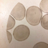 c. 1870 Microphotograph of Blood Cells Under Microscope, Dr. S. W. Fletcher, Pepperell MA (1 of 2)
