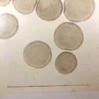 c. 1870 Microphotograph of Blood Cells Under Microscope, Dr. S. W. Fletcher, Pepperell MA (1 of 2)
