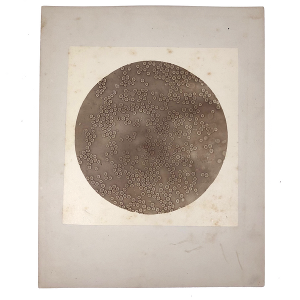 c. 1870 Microphotograph of Blood Cells Under Microscope, Dr. S. W. Fletcher, Pepperell MA (2 of 2)