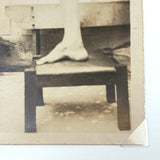 Beautifully Composed, Poetic Old Presumed Medical Snapshot Photo of Propped Leg and Foot