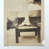Beautifully Composed, Poetic Old Presumed Medical Snapshot Photo of Propped Leg and Foot