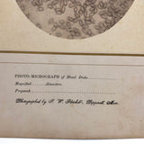 Stunning Early Microphoto (c. 1870s) of Blood Disks, Pepperell, MA