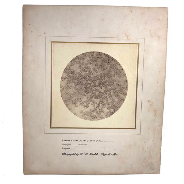 Stunning Early Microphoto (c. 1870s) of Blood Disks, Pepperell, MA