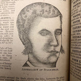 Dr. B.J Kimball's "The Doctor at Home" 1883 Medical Guide for Humans and Horses!
