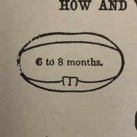 How and When First Teeth Come, Antique Bookplate Print