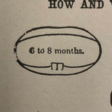 How and When First Teeth Come, Antique Bookplate Print